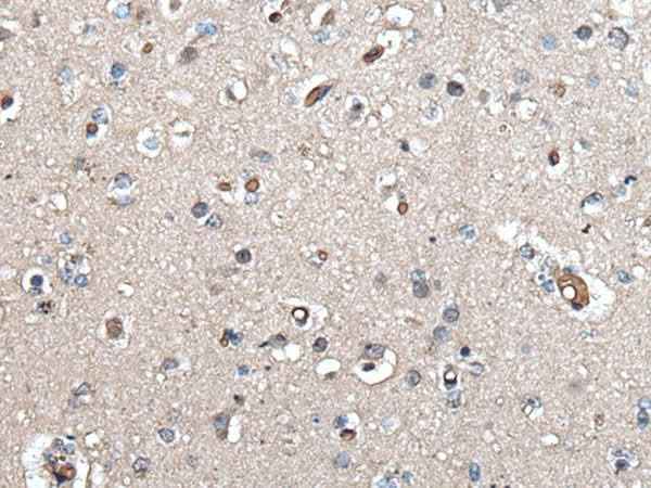 Anti-Human/Mouse UMPS Antibody