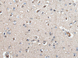 Immunohistochemistry of paraffin-embedded Human brain tissue using UMPS Polyclonal Antibody at dilution of 1:40(×200)