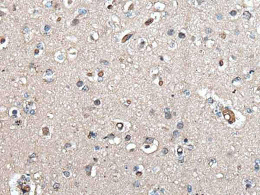 Anti-Human/Mouse UMPS Antibody