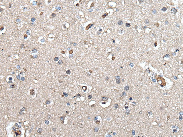 Immunohistochemistry of paraffin-embedded Human brain tissue using UMPS Polyclonal Antibody at dilution of 1:40(×200)