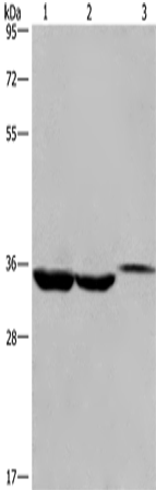 Anti-Human/Mouse ING2 Antibody - ABMIUM