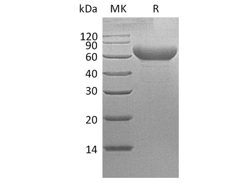 Recombinant Cynomolgus TIM-3/HAVCR2 Protein (Fc Tag) - ABMIUM