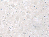 Immunohistochemistry of paraffin-embedded Human brain tissue using SST Polyclonal Antibody at dilution of 1:60(×200)