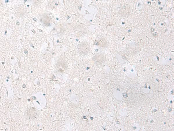 Immunohistochemistry of paraffin-embedded Human brain tissue using SST Polyclonal Antibody at dilution of 1:60(×200)