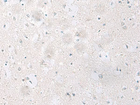 Immunohistochemistry of paraffin-embedded Human brain tissue using SST Polyclonal Antibody at dilution of 1:60(×200)
