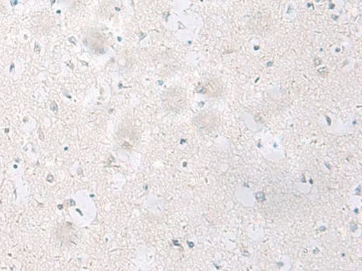 Immunohistochemistry of paraffin-embedded Human brain tissue using SST Polyclonal Antibody at dilution of 1:60(×200)