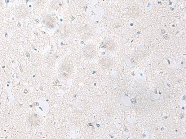 Immunohistochemistry of paraffin-embedded Human brain tissue using SST Polyclonal Antibody at dilution of 1:60(×200)