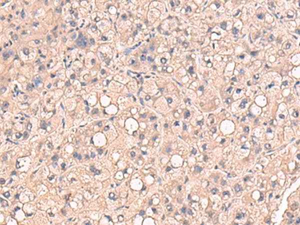 Anti-Human/Mouse RIOK1 Antibody