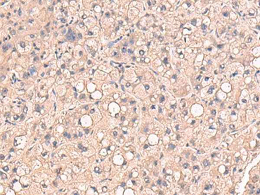 Anti-Human/Mouse RIOK1 Antibody