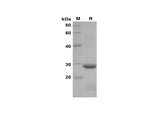 SDS-PAGE analysis of Rat CXCL5/LIX proteins, 2 μg/lane of Recombinant Rat CXCL5/LIX proteins was resolved with SDS-PAGE under reducing conditions, showing bands at 29 kDa.
