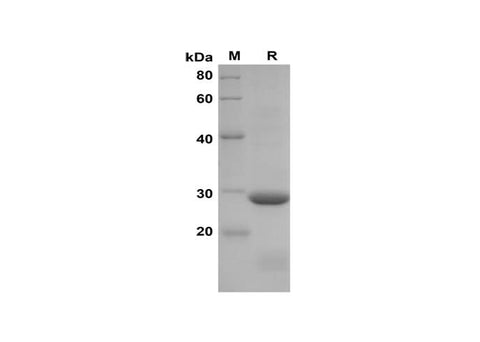 SDS-PAGE analysis of Rat CXCL5/LIX proteins, 2 μg/lane of Recombinant Rat CXCL5/LIX proteins was resolved with SDS-PAGE under reducing conditions, showing bands at 29 kDa.