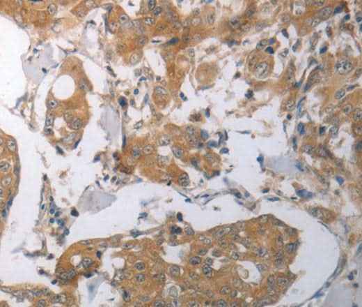 Anti-Human/Mouse/Rat SHH Antibody