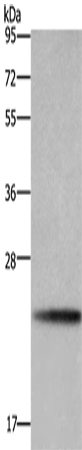 Anti-Human BBC3 Antibody - ABMIUM