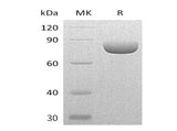 Recombinant Mouse Semaphorin-4A/SEMA4A Protein (His Tag) - ABMIUM