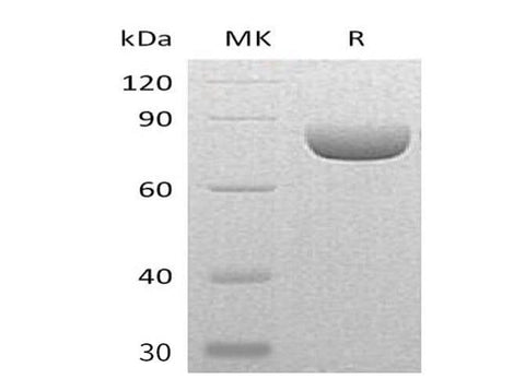 Recombinant Mouse Semaphorin-4A/SEMA4A Protein (His Tag) - ABMIUM