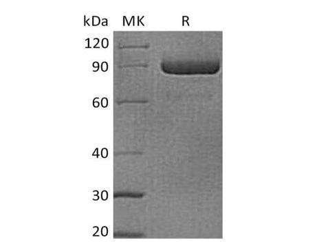 Recombinant Human LAG3/CD223 Protein (mFc Tag) - ABMIUM