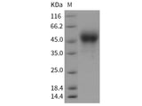 Recombinant Rat Tissue Factor/CD142 Protein (His Tag) - ABMIUM