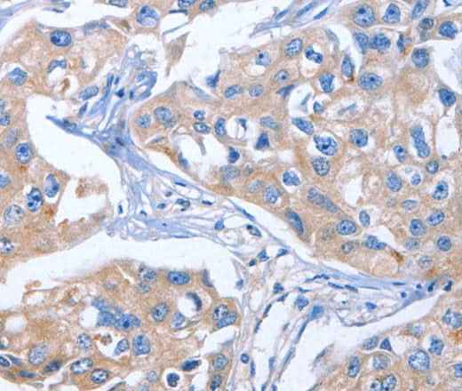 Anti-Human/Mouse IBSP Antibody