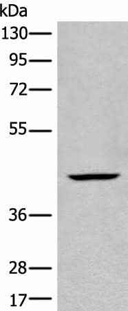 Anti-Human/Mouse/Rat BBOX1 Antibody