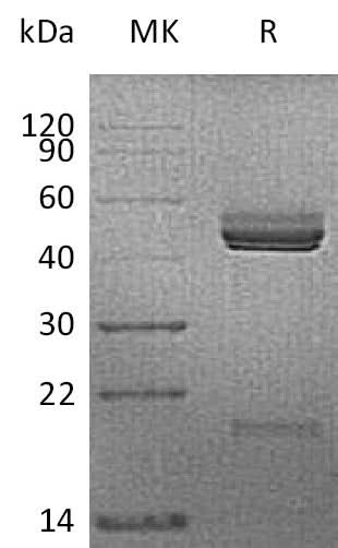 Recombinant Mouse IL-23/Interleukin-23(IL23A&IL12B) Protein (His Tag) - ABMIUM
