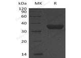 Recombinant Human KLK-8/Kallikrein-8 Protein (His Tag) - ABMIUM