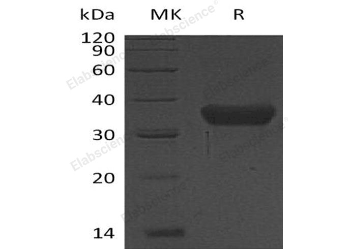 Recombinant Human KLK-8/Kallikrein-8 Protein (His Tag) - ABMIUM