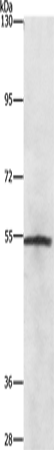 Anti-Human/Mouse NEK2 Antibody - ABMIUM