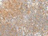 Immunohistochemistry of paraffin-embedded Human tonsil tissue using RAPGEF1 Polyclonal Antibody at dilution of 1:45(×200)