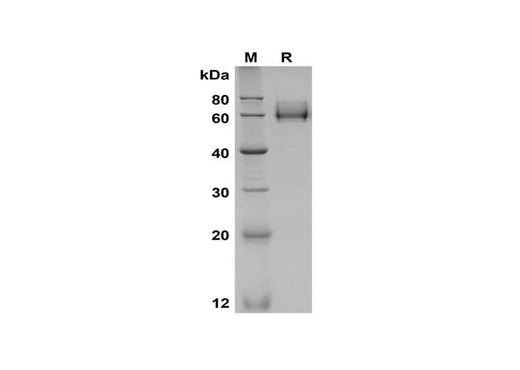SDS-PAGE analysis of Mouse KIM-1 proteins, 2 μg/lane of Recombinant Mouse KIM-1 proteins, was resolved with SDS-PAGE under reducing conditions, showing bands at 60-65 kDa.