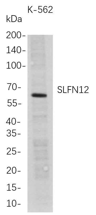Anti-Human SLFN12 Antibody [B714] - ABMIUM
