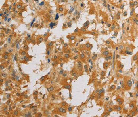 Anti-Human/Mouse ATG4D Antibody