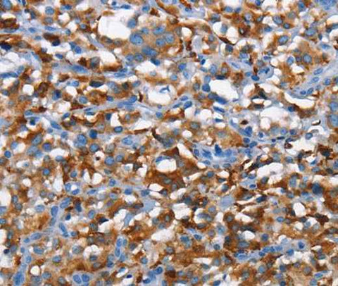 Anti-Human CD226 Antibody