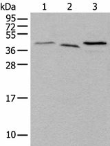 Western blot analysis of Mouse brain tissue Hela and HEPG2 cell lysates using UBXN1 Polyclonal Antibody at dilution of 1:500