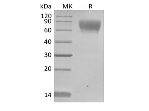 Recombinant Human TPBG/5T4 (C-Avi-6His) Biotinylated - ABMIUM