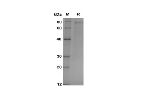 SDS-PAGE analysis of Human PAK6 proteins, 2 μg/lane of Recombinant Human PAK6 proteins was resolved with SDS-PAGE under reducing conditions, showing bands at 80 kDa.