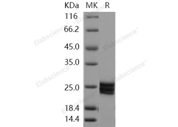 Recombinant Human ESM1/Endocan Protein (His Tag) - ABMIUM