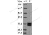 Recombinant Human ESM1/Endocan Protein (His Tag) - ABMIUM