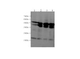 Anti-Human/Mouse/Rat JNK2 Antibody - ABMIUM