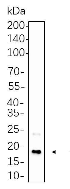 Anti-Human CENP-A Antibody [B589] - ABMIUM