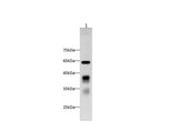 Anti-Mouse Clusterin Antibody - ABMIUM