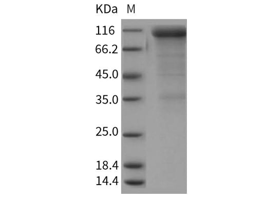 > 85 % as determined by reducing SDS-PAGE.