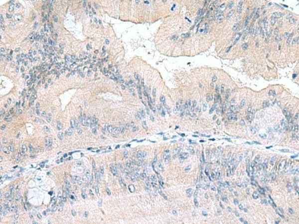 Anti-Human/Mouse/Rat UBE2F Antibody