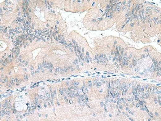 Anti-Human/Mouse/Rat UBE2F Antibody