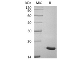 Recombinant Human ACP1/LMW-PTP Protein (His Tag) - ABMIUM