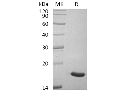 Recombinant Human ACP1/LMW-PTP Protein (His Tag) - ABMIUM