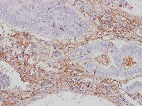 Anti-Human CTLA4 Antibody - ABMIUM