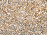 Immunohistochemistry of paraffin-embedded Human tonsil tissue using LGALS9 Polyclonal Antibody at dilution of 1:40(×200)