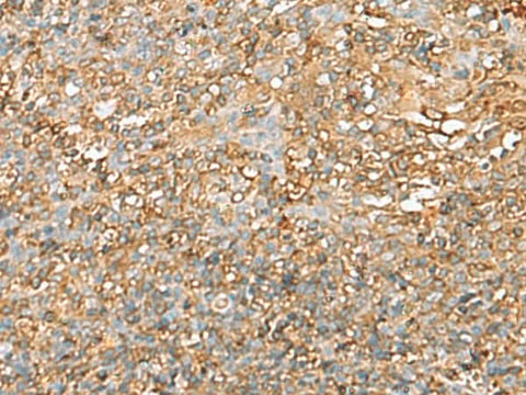 Immunohistochemistry of paraffin-embedded Human tonsil tissue using LGALS9 Polyclonal Antibody at dilution of 1:40(×200)