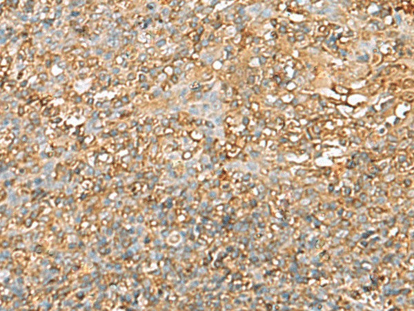 Immunohistochemistry of paraffin-embedded Human tonsil tissue using LGALS9 Polyclonal Antibody at dilution of 1:40(×200)