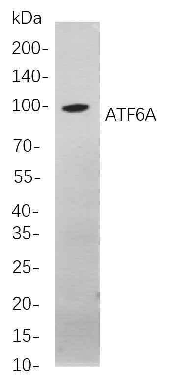 Anti-Human/Mouse/Rat ATF6A Antibody [B848] - ABMIUM
